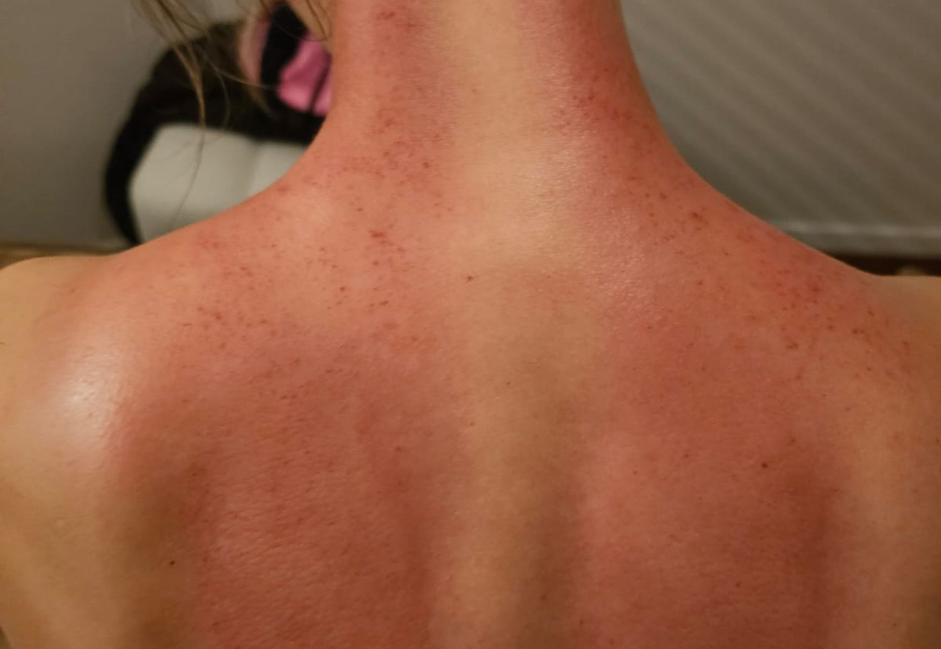 Gua Sha massage