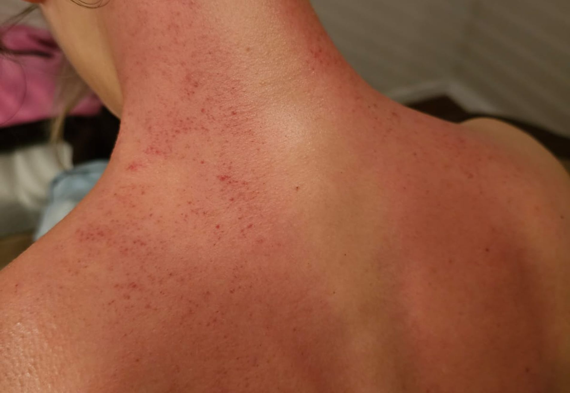 Gua Sha massage