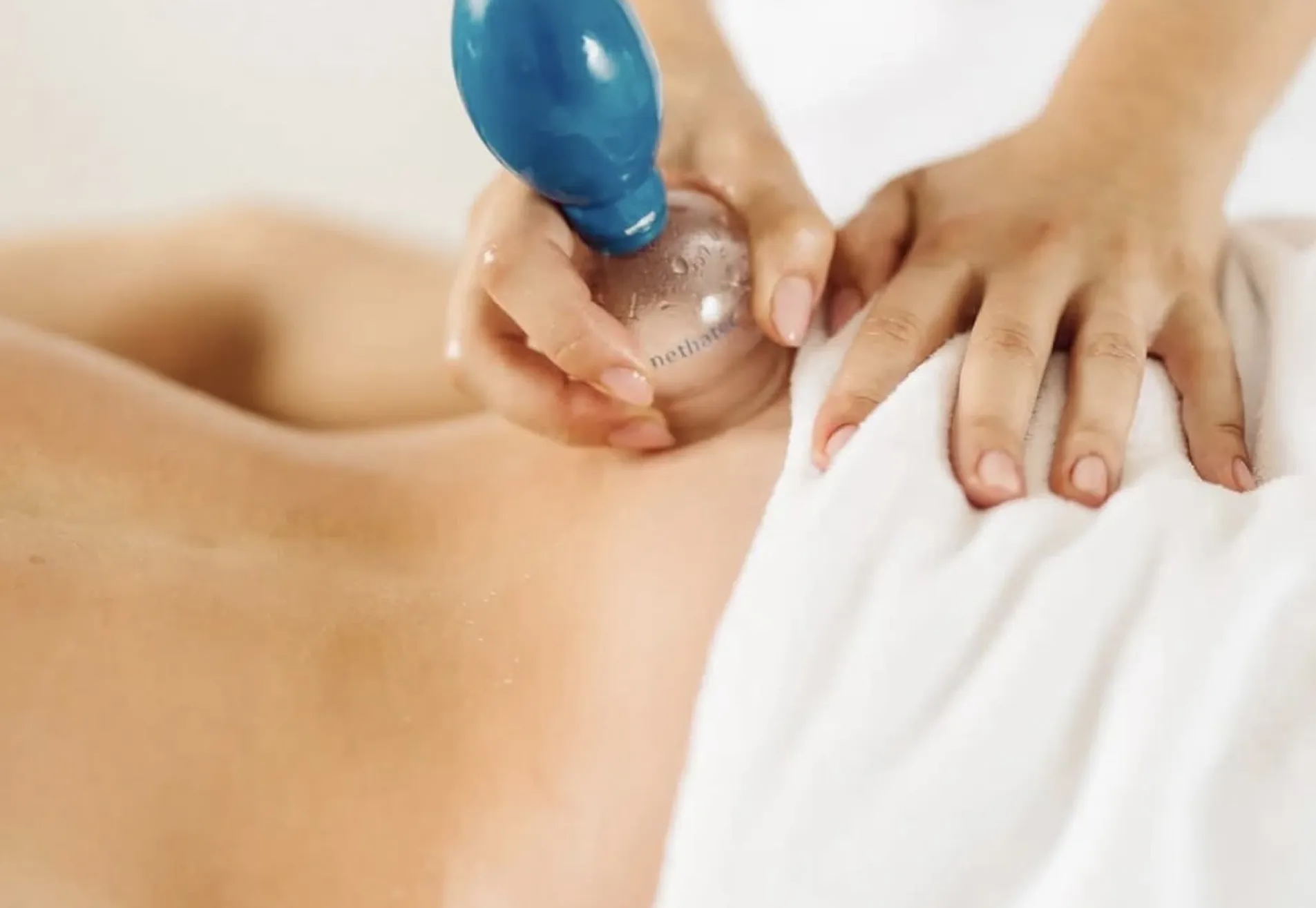 Cupping massage